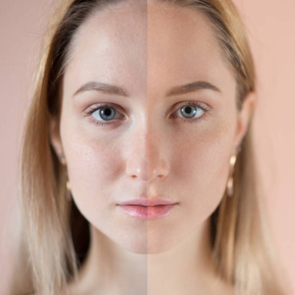 Beauty retouch